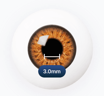 낮 - 3.0mm